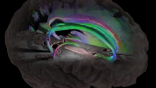 Big data study at USC to investigate link between gender and Alzheimer’s risk