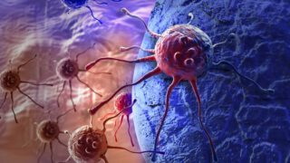 Can artificial intelligence help to detect and cure cancer?