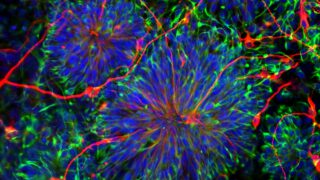 From restoring sight to reversing brain damage, USC stem cell researchers are making life-changing discoveries